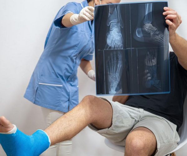 Radiografía de un primer plano de fractura de pie en una consulta con un médico.